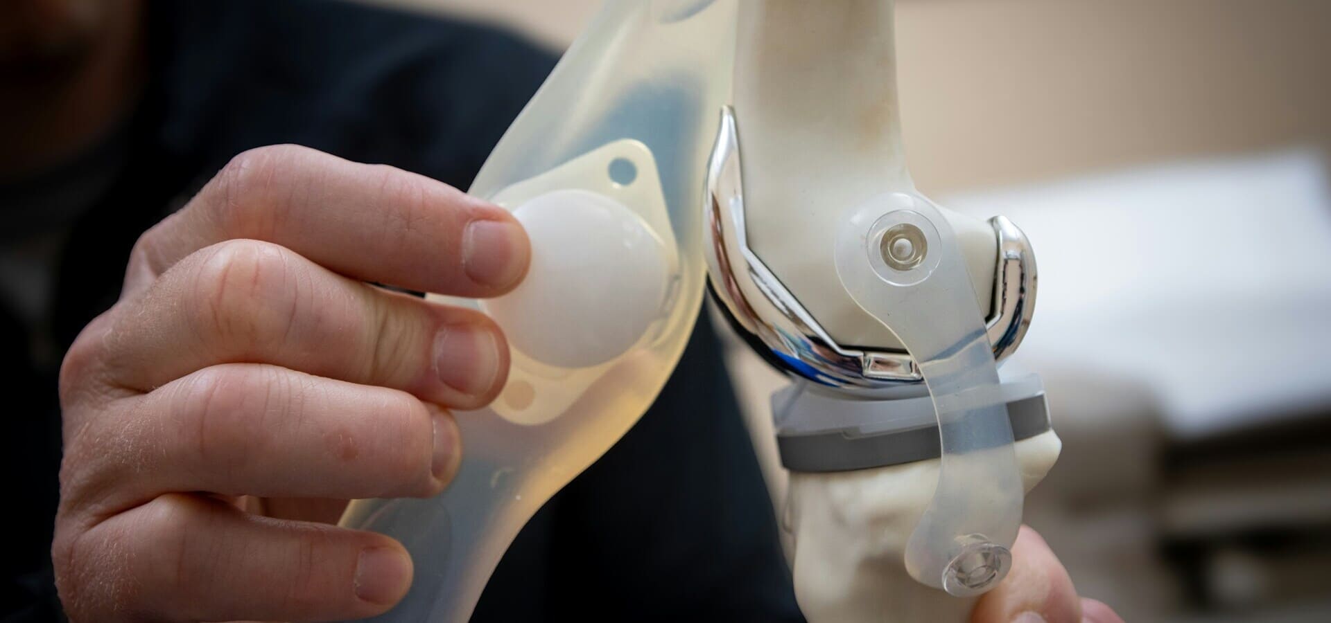 Still Weak After Knee Replacement? What New PT Guideline Says